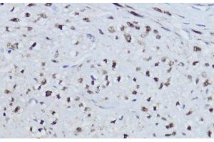 ESRRA antibody