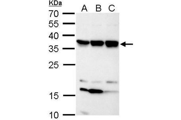 C11orf54 anticorps