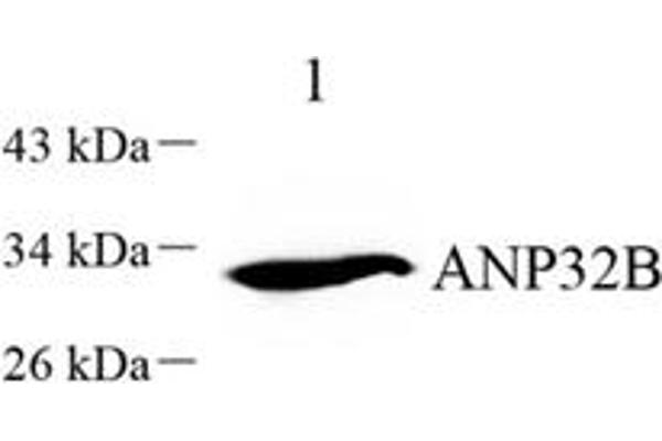 ANP32B antibody