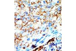 Image no. 1 for anti-NME/NM23 Nucleoside Diphosphate Kinase 4 (NME4) (C-Term) antibody (ABIN360669) (NME4 antibody  (C-Term))