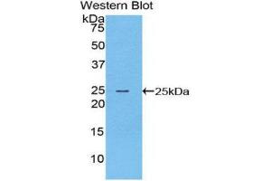 Western Blotting (WB) image for anti-Filaggrin (FLG) (AA 3905-4031) antibody (ABIN1078038)