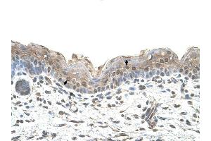 Ribophorin II antibody was used for immunohistochemistry at a concentration of 4-8 ug/ml to stain Squamous epithelial cells (arrows) in Human Skin.