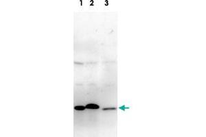 Detection of Glo1 protein by Western blotting with Glo1 monoclonal antibody, clone 6F10 .