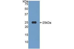 WB of Protein Standard: different control antibodies  against Highly purified E. (Afamin ELISA Kit)