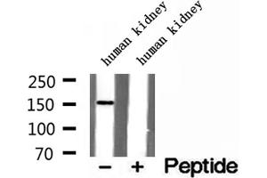 Western blot analysis of extracts of human kidney tissue, using RPGRIP1L antibody. (RPGRIP1L antibody  (N-Term))