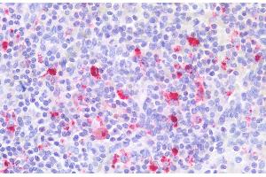 ABIN2613445 (5 μg/mL) staining of paraffin embedded Human Spleen. (Integrin beta 2 antibody  (AA 86-99))