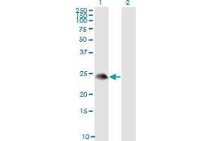 Western Blot analysis of TSC22D3 expression in transfected 293T cell line by TSC22D3 monoclonal antibody (M01), clone 3A5.