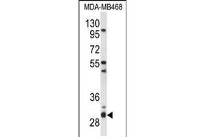 Western blot analysis of PSMG2 Antibody in MDA-MB468 cell line lysates (35ug/lane)