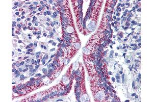 Anti-ACAA2 antibody IHC of human small intestine.