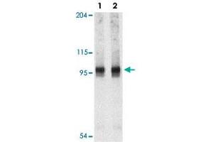Western blot analysis of NARP2 in PC-3 cell lysate with NLRP2 polyclonal antibody  at 1 and 2 ug/mL . (NLRP2 antibody  (C-Term))