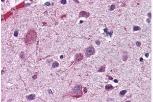 Human Brain, Cortex: Formalin-Fixed, Paraffin-Embedded (FFPE) (ACSL4 antibody  (N-Term))