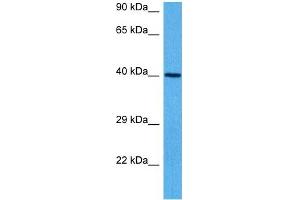 Host:  Mouse  Target Name:  GNAS  Sample Tissue:  Mouse Heart  Antibody Dilution:  1ug/ml (GNAS antibody  (N-Term))