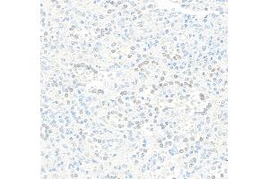 Immunohistochemistry (IHC) image for anti-Jun Dimerization Protein 2 (JDP2) (AA 50-100) antibody (ABIN7795636) (Recombinant JDP2 antibody  (AA 50-100))