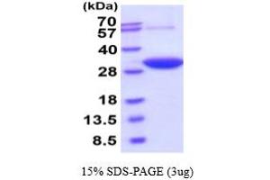SDS-PAGE (SDS) image for Dicarbonyl/L-Xylulose Reductase (DCXR) (AA 1-244) (Active) protein (His tag) (ABIN6387971)