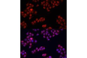 Immunofluorescence analysis of HeLa cells using Y antibody (ABIN6132789, ABIN6150317, ABIN6150322 and ABIN6215136) at dilution of 1:100. (YAP1 antibody  (AA 155-504))