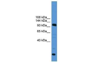 Western Blot showing USP15 antibody used at a concentration of 1-2 ug/ml to detect its target protein.