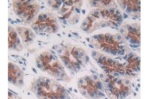 DAB staining on IHC-P; Samples: Human Stomach Tissue (ACP5 antibody  (AA 79-318))