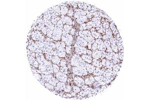 Adrenal gland STING staining of endothelial cells and of macrophages STING immunohistochemistry (STING1 (AA 190-290) antibody)