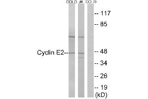 Immunohistochemistry analysis of paraffin-embedded human thyroid gland tissue using Cyclin(Ab-392) antibody. (Cyclin E2 antibody)