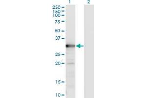 Western Blot analysis of TYMS expression in transfected 293T cell line by TYMS monoclonal antibody (M02), clone 2B2. (TYMS antibody  (AA 111-210))