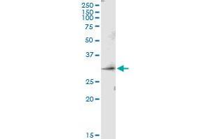 Immunoprecipitation of PRSS1 transfected lysate using anti-PRSS1 MaxPab rabbit polyclonal antibody and Protein A Magnetic Bead , and immunoblotted with PRSS1 purified MaxPab mouse polyclonal antibody (B01P) . (PRSS1 antibody  (AA 1-247))