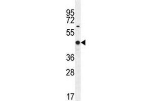 WT1 antibody western blot analysis in MCF-7 lysate. (WT1 antibody  (AA 346-375))