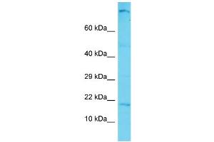 Host: Rabbit Target Name: C12orf74 Sample Type: Hela Whole cell lysates Antibody Dilution: 1. (C12ORF74 antibody  (N-Term))