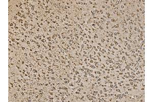 anti-Eukaryotic Translation Initiation Factor 5 (EIF5) (AA 11-423) antibody