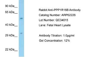 Western Blotting (WB) image for anti-Protein Phosphatase 1, Regulatory Subunit 16B (PPP1R16B) (N-Term) antibody (ABIN2774338) (PPP1R16B antibody  (N-Term))