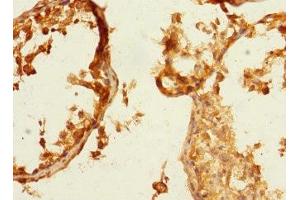Immunohistochemistry of paraffin-embedded human testis tissue using ABIN7161113 at dilution of 1:100 (nectin-3 antibody  (AA 310-549))
