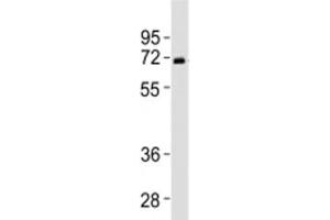 Western blot testing of SPHK2 antibody at 1:2000 dilution + human liver lysate (SPHK2 antibody  (N-Term))