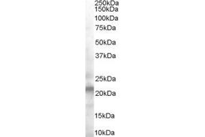 COL27A1 antibody  (Middle Region)