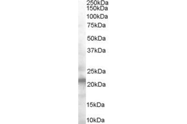 COL27A1 antibody  (Middle Region)