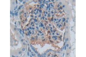 Used in DAB staining on fromalin fixed paraffin- embedded Kidney tissue (Aurora Kinase C antibody  (AA 92-339))