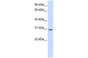 RBM7 antibody used at 1 ug/ml to detect target protein. (RBM7 antibody  (Middle Region))