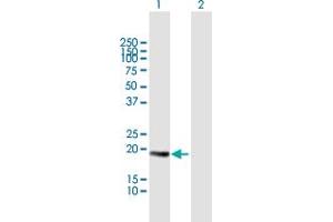 Western Blot analysis of CETN3 expression in transfected 293T cell line by CETN3 MaxPab polyclonal antibody. (CETN3 antibody  (AA 1-167))
