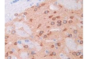 Detection of HGF in Rat Cerebrum Tissue using Polyclonal Antibody to Hepatocyte Growth Factor (HGF) (HGF antibody  (AA 306-471))