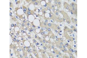 Immunohistochemistry of paraffin-embedded Human liver damage using PRODH Polyclonal Antibody at dilution of 1:100 (40x lens).