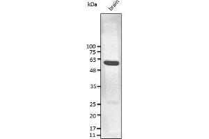 Anti-GFAP Ab at 1/2,500 dilution, lysates at 50 ug per Iane, rabbit polyclonal to goat lgG (HRP) at 1/10,000 dilution, (GFAP antibody  (C-Term))
