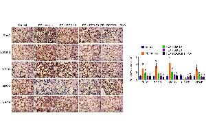 IHC analyzes the expression of RhoA, ROCK, p-MLC, eNOS and VEGF in placenta from PE miceRepresentative images of IHC staining for RhoA, ROCK, p-MLC, eNOS and VEGF (left), and quantification (right). (VEGFA antibody  (AA 81-132))