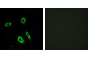 Peptide - +Western blot analysis of extracts from Jurkat cells, using EDG7 antibody. (LPAR3 antibody  (Internal Region))