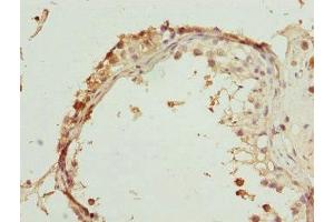 Immunohistochemistry of paraffin-embedded human testis tissue using ABIN7168463 at dilution of 1:100 (RUFY2 antibody  (AA 396-655))
