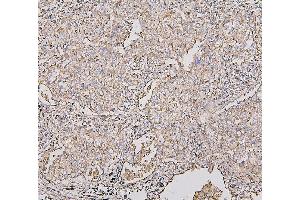 IHC analysis of COX IV using anti-COX IV antibody (ABIN7602090). (COX IV antibody  (AA 59-169))