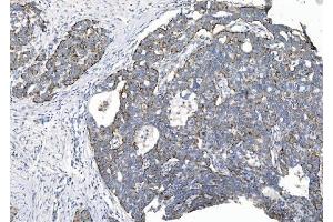 IHC analysis of CHCHD10 using anti-CHCHD10 antibody (ABIN7602507). (CHCHD10 antibody  (AA 80-142))