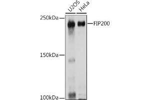 Western blot analysis of extracts of various cell lines, using FIP200 Rabbit pAb (ABIN7269881) at 1:1000 dilution. (FIP200 antibody  (C-Term))