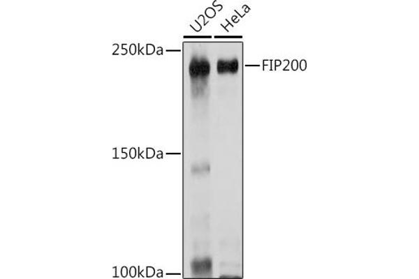 FIP200 抗体  (C-Term)