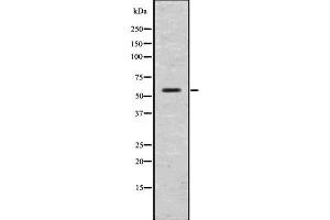 Western blot analysis of GLP1R using COLO205 whole  lysates.