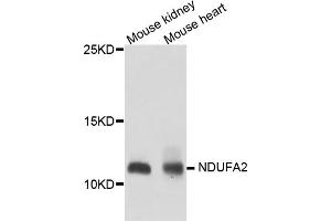 Western blot analysis of extracts of various cell lines, using NDUFA2 antibody (ABIN5974497) at 1/1000 dilution. (NDUFA2 antibody)