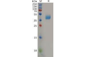 Human CCR2 Protein, hFc Tag on SDS-PAGE under reducing condition. (CCR2 Protein (Fc Tag))