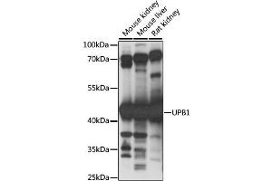 Western blot analysis of extracts of various cell lines, using UPB1 antibody. (UPB1 antibody)